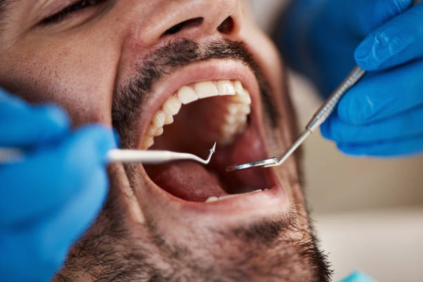 Best Tooth Pain Emergency Relief  in Pikesville, MD